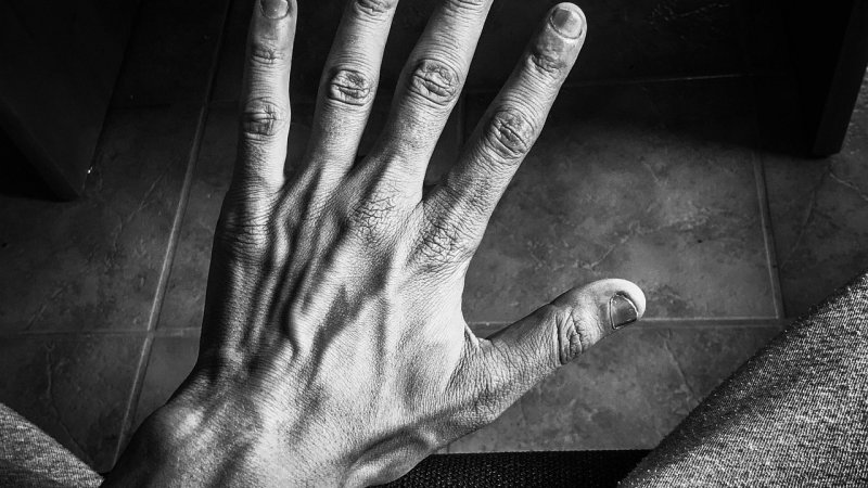 Zdjęcie: Bioderma Cicabio: krem regeneracyjny do podrażnień, ran i blizn